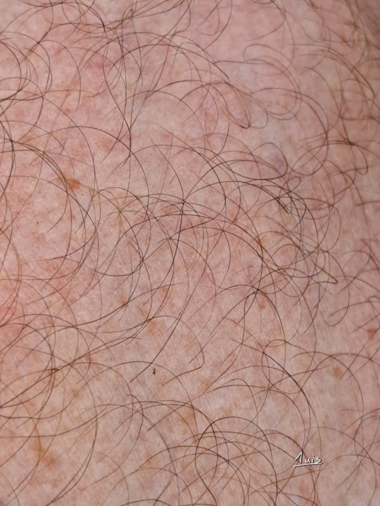 Peau par August Luis