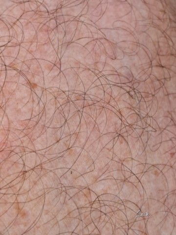 Peau par August Luis